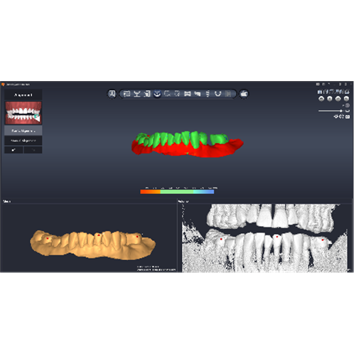 [3D Industrial] DentiqGuide