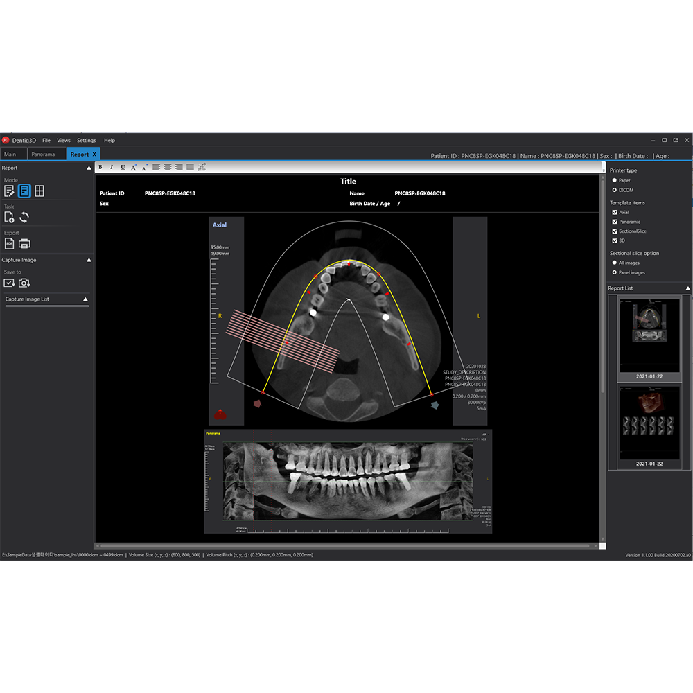 [3D Industrial] Dentiq3D