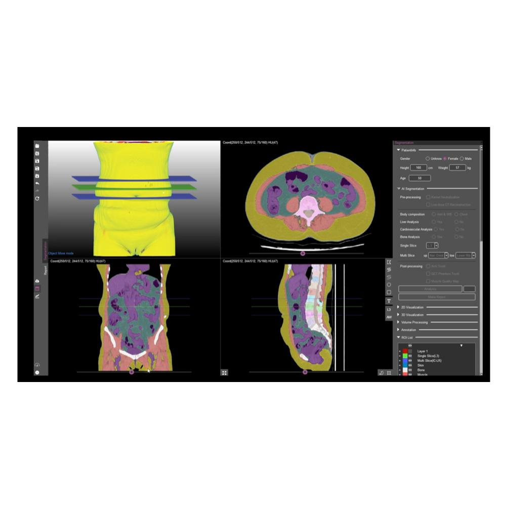 MEDICAL IP DeepCatch